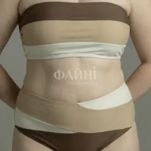 Жінка в смугастому купальнику